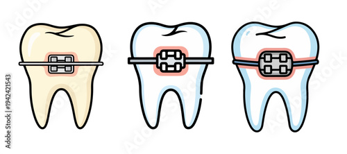 ector Illustration Set of Human Teeth with Metal Dental Braces Isolated on White Background
