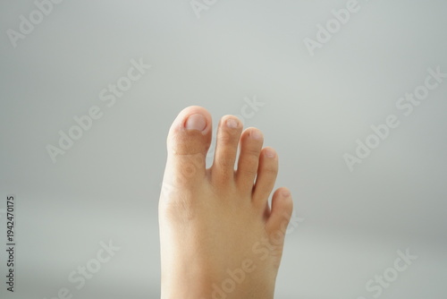 Both human feet with visible toes on a plain background, showing natural skin and foot details.