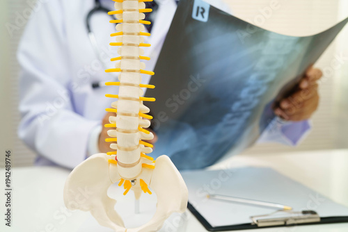 Foto Doctor examining spine bone radiography xray film.