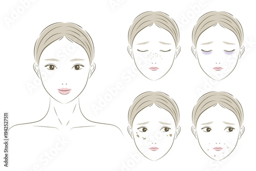 女性の肌トラブルやお悩みイラストセット、シミ、そばかす、ニキビ、クマ、毛穴