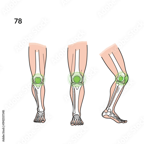 Knee joint anatomy illustration with pain areas highlighted in green medical diagram