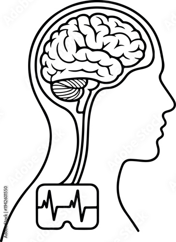 Minimalist line art of human head profile showing brain with medical implant device and deep brain stimulation wires