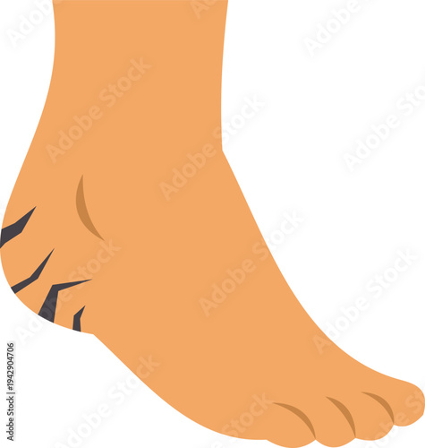 Illustration showing cracked heel dryness symbolizing foot care and skincare issues