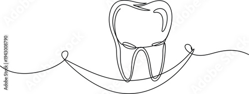 A line drawing of a dental implant with a screw and abutment