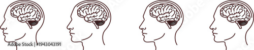 Illustration of four human brain profiles in side view