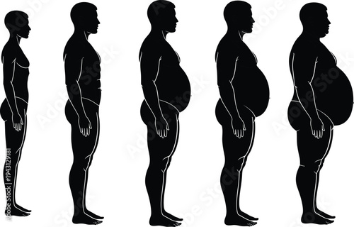 Human body weight gain stages silhouette showing slim to obese male body transformation health fitness and obesity concept vector