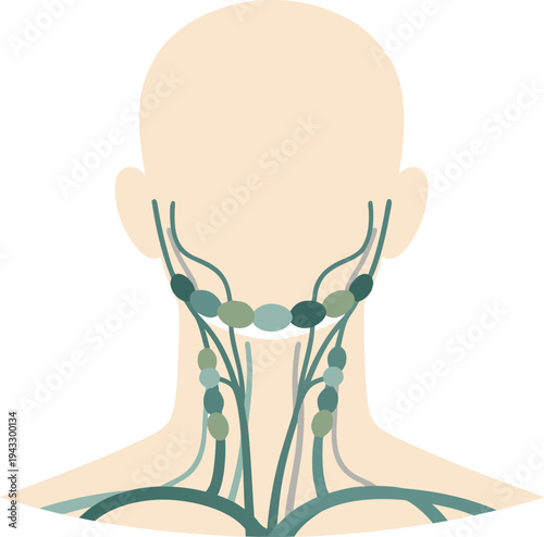 Illustration of a faceless neck silhouette showing the lymphatic system with enlarged lymph nodes along both sides, representing infection, lymphoma, or swollen glands in the cervical region