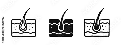 Hair Follicle and Skin Anatomy Icon Set: Line, Glyph, and Hand-Drawn Styles