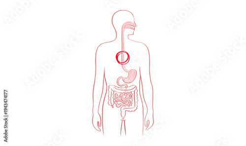 Esophagus pain diagram