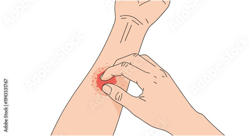 A light-skinned arm with a prominent red, circular rash on its forearm is being actively scratched by a hand against a clean white background.