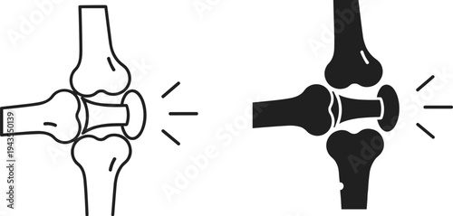 knee joint pain medical icon, human leg bone anatomy with inflammation symbol for orthopedic healthcare concept, flat vector illustration