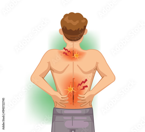 Upper and Lower Back Pain Areas Medical Illustration