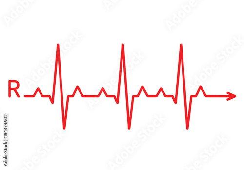Graphic representation of an electrocardiogram rhythm strip showing heartbeats isolated on transparent background, Vector