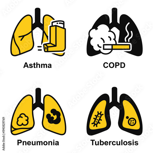 Vector art of four icons illustrating lung diseases asthma with inhaler, copd with smoke, pneumonia with bacteria, and tuberculosis with bacilli