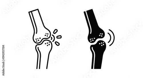 Knee Joint Osteoarthritis Medical Illustration Icons Set - Line and glyph icon set - Minimalist, flat icon, outline, glyph, linear, clipart, sticker - icon set