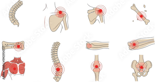 human, body, pain, points, anatomy, skeleton, joints, inflammation, orthopedic, medical, illustration, bone, injury, arthritis, spine, shoulder, knee, hip, elbow, diagnosis
