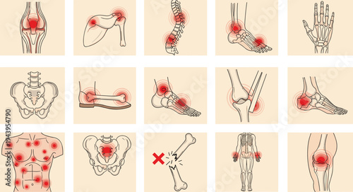 human, joint, pain, anatomy, medical, orthopedic, skeleton, bones, inflammation, arthritis, injury, spine, knee, shoulder, hip, elbow, diagnosis, healthcare, illustration, vector