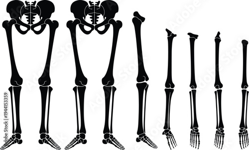 Detailed comparative illustration of human lower limb skeleton anatomy showing pelvis, femur, tibia, fibula, and foot bones variations