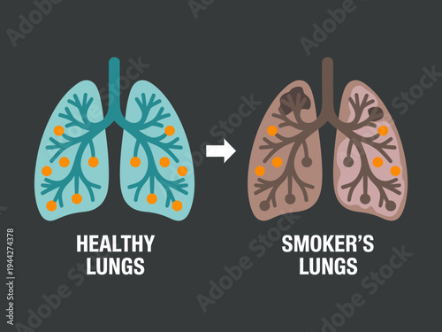 Healthy lungs versus smokers lungs comparison with bronchi and trachea