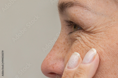 Schilderij op canvas Smiling mature woman touching skin around eye with fingers