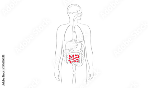 Intestine diseases sketch