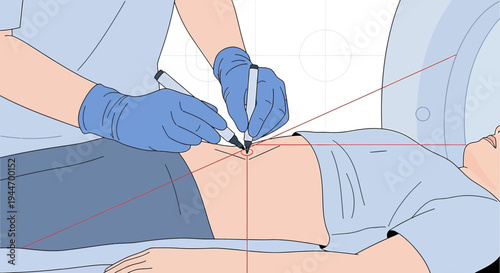 Surgeon Marking Patient's Abdomen for Surgery with Surgical Pen