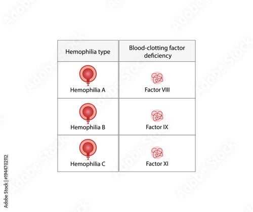 Hemophilia, a bleeding disorder that slows the blood clotting. Haemophilia types A,B,C Coagulation disorder. Gene mutations, Blood clotting factors deficiency VIII, IX, XI. Vector illustration.
