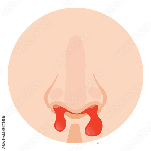 Sinus Infection Illustration