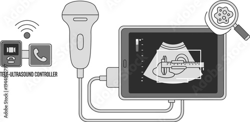 Tele ultrasound controller displays a fetal measurement on a tablet screen connected to a wireless probe for remote medical imaging.