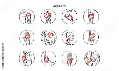 Arthritis Sketch Poster