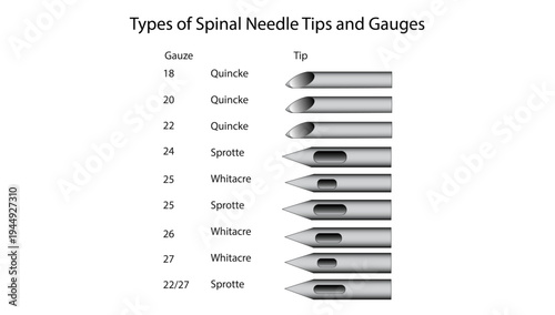 Types of Spinal Needle Tips and Gauges, different spinal needle gauges and tip designs including Quincke, Sprotte, and Whitacre used for lumbar puncture and spinal anesthesia.