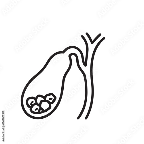 Gallbladder stones cholelithiasis line icon. Digestive organ vector illustration isolated on white background.