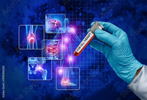 Stem Cell Therapy Concept donation and human regenerative treatment donating stem cells as Regenerative Medicine as Mesenchymal Cells in a test tube with a Doctor or researcher holding a glass contain