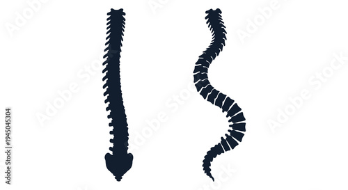 Two contrasting views of a human spine are depicted in a stark graphic silhouette high quality