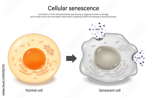 Cellular senescence. Normal cell and senescence cell. Zombie cells. Hallmarks of ageing.
