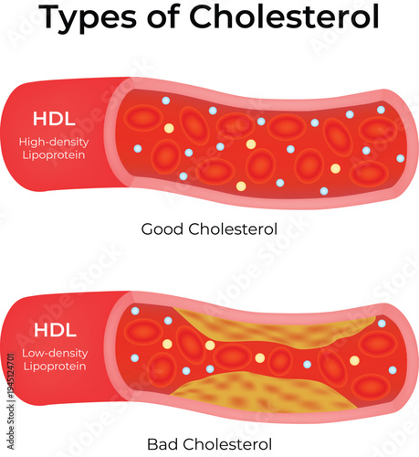 Types of Cholesterol Illustration HDL vs LDL in Blood Vessels Vector illustration