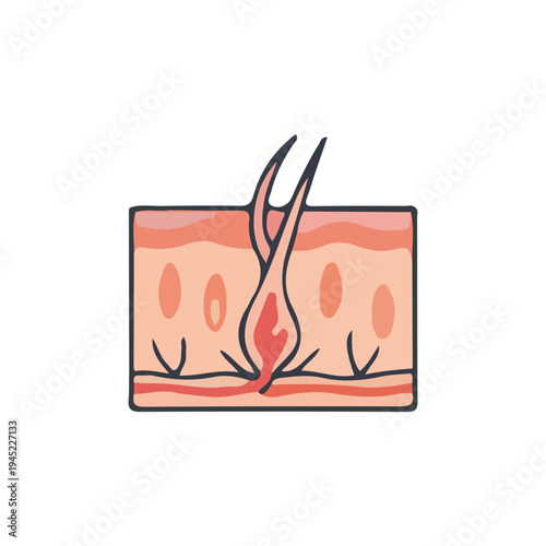 Skin Hair Follicle Diagram