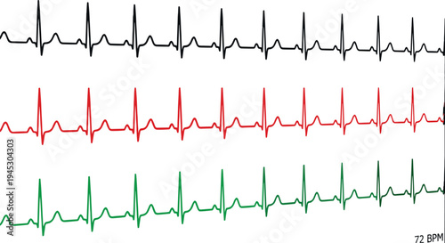 Electrocardiogram ECG heartbeat waveform illustration, multicolor heart rhythm monitoring lines showing cardiac pulse signal medical cardiology diagnostic concept