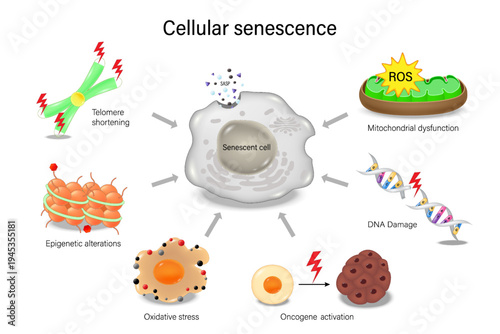 Cellular senescence. Zombie cells. Telomere Shortening, Epigenetic Alterations, Oxidative Stress, Oncogene Activation, DNA Damage and Mitochondrial dysfunction.