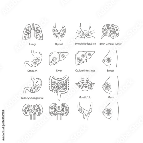 Human body organs with tumors