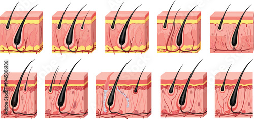 Human Skin and Hair Follicle Anatomy Diagram Set Showing Hair Growth Cycle, Skin Layers, and Follicle Structure for Medical, Dermatology, and Education Design