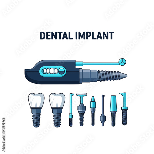 Innovative Dental Implant Tools and Equipment for Modern Tooth Restoration Procedures