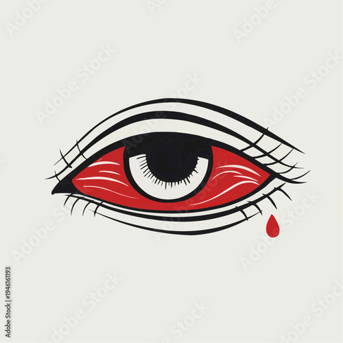 Flat vector illustration of an irritated red eye with a tear, suitable for medical articles, health campaigns, or educational materials.