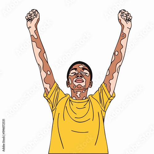 Person with vitiligo celebrating with arms raised high.