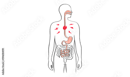 Esophagus pain diagram