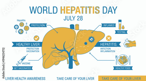 World Hepatitis Day Awareness Infographic vector illustration