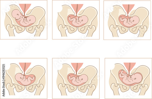 Medical vector illustration set showing human fetal development and baby positions in the womb during pregnancy and childbirth stages.