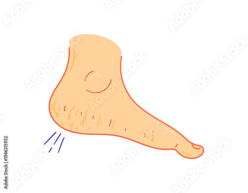 Illustration of cracked and dry skin on the soles of the feet. Fissures concept. Skin diseases and health problems. Flat style illustration with outline. White background.