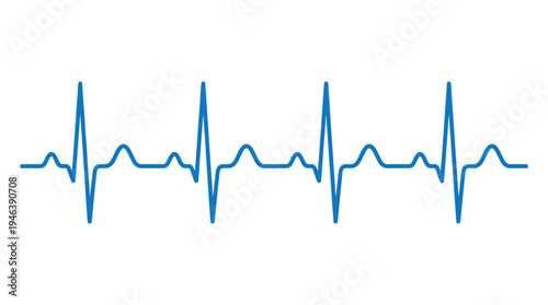 heart beat cardiogram