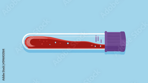 Medical test tube with red liquid and purple cap on light blue background for laboratory or healthcare concept